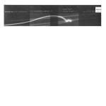 MANDALAY - Not Seventeen - Disque Maxi 45T x 2